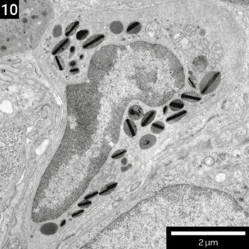 STEM-DF images of granulocytes in lungs. S9000-singlebeam-10.jpg